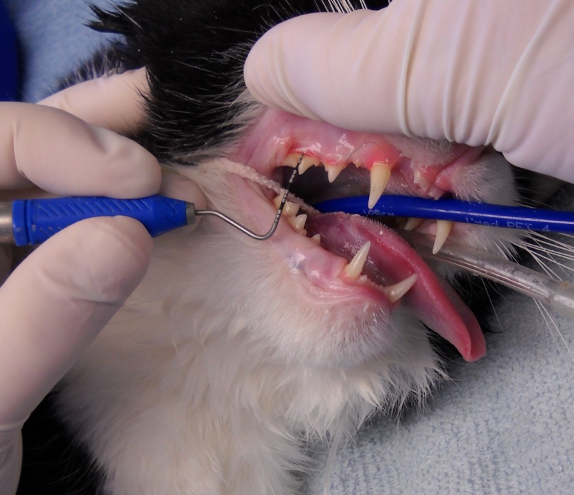 periodontal probing